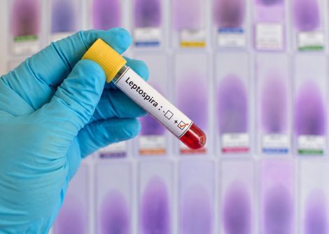 Fallas en agua, drenaje y recolección de basura incrementan el riesgo de leptospirosis en Piura.